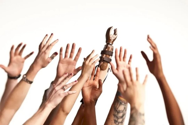 The image shows multiple human hands reaching up alongside a prosthetic arm with a mechanical hand, all against a plain white background.